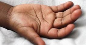A photo of a child's hand with the palm facing up