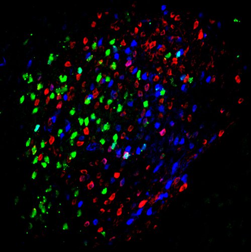 neuronal subpopulations in the amygdala central nucleus