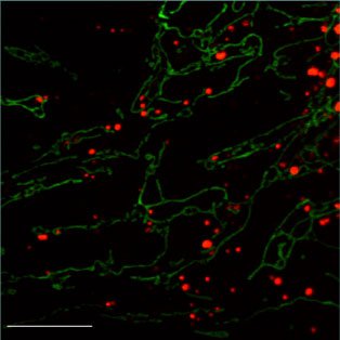 Mitofusins are required on adjacent mitochondria to mediate membrane fusion.