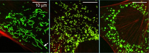 Fragmentation of mitochondria