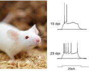 mouse and neuoronal activity