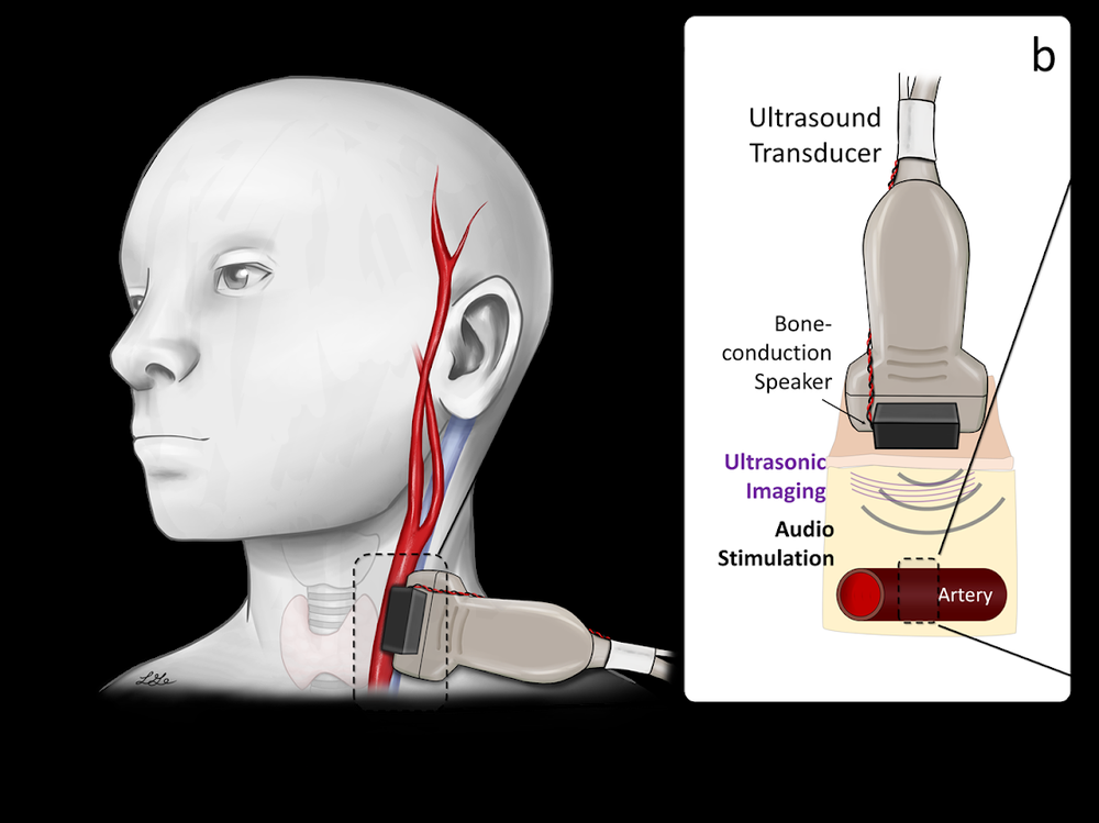 Yaser Research Overview Figure 1