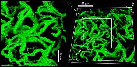 Glowing green serpentine "cables" made up of proliferating bacterial cells.