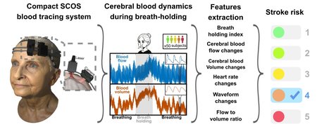 A figure showing an older woman's head on the far left, wearing the laser-based headset device, two spectra in the center showing blood flow and blood volume over time, highlighting what happens during breath holding, and then stroke risk determination on a scale from 1-5 on the right.