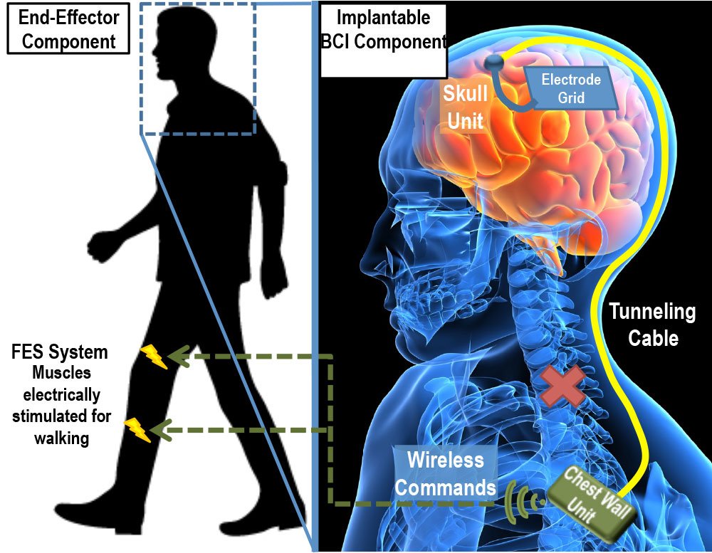 a diagram of a person and a brain