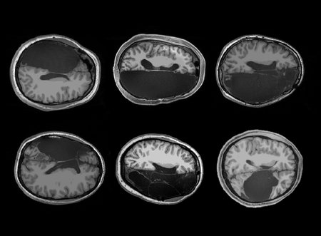 Six brain scans