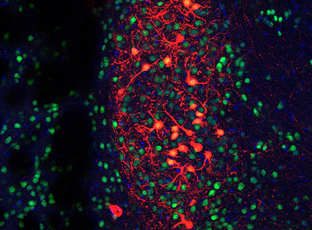 A web of neurons stained red, blue, and green
