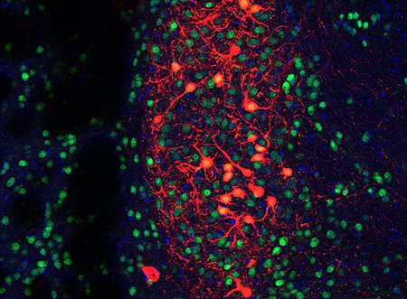 A web of neurons stained red, blue, and green