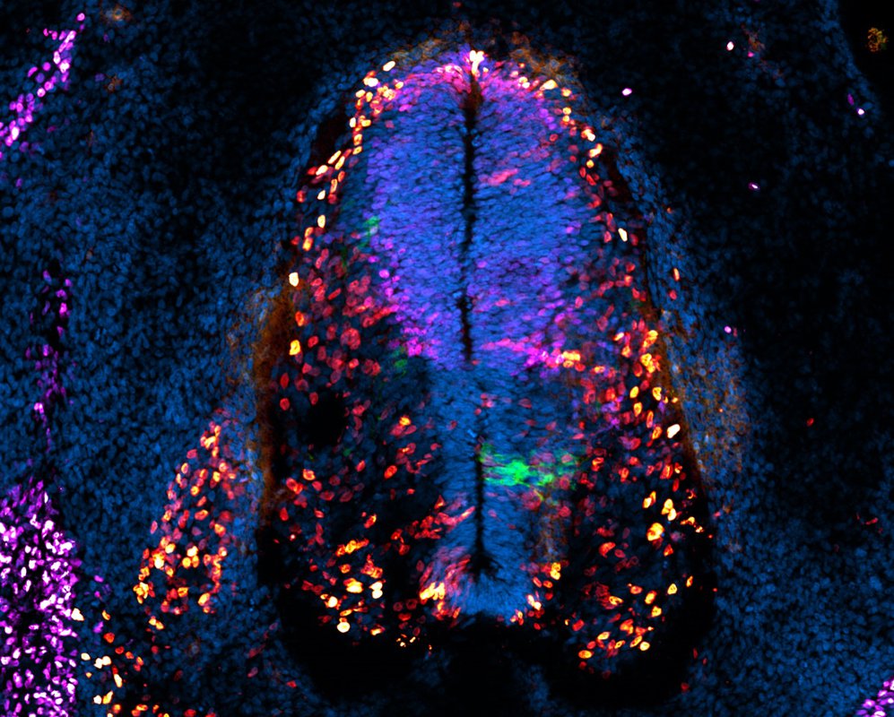 A colorful microscope image of the cells of the spinal cord of a chicken embryo.
